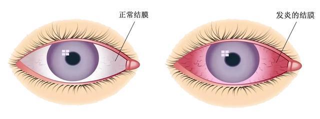 一夜之间300多人进急诊，近期高发，紧急提醒