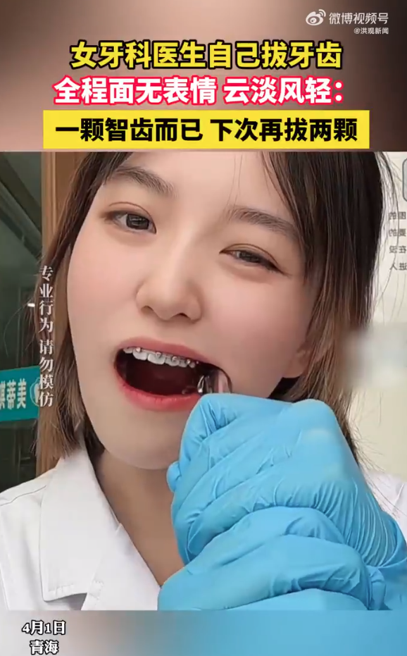 牙科医生给自己拔智齿超淡定 网友：是个狠人