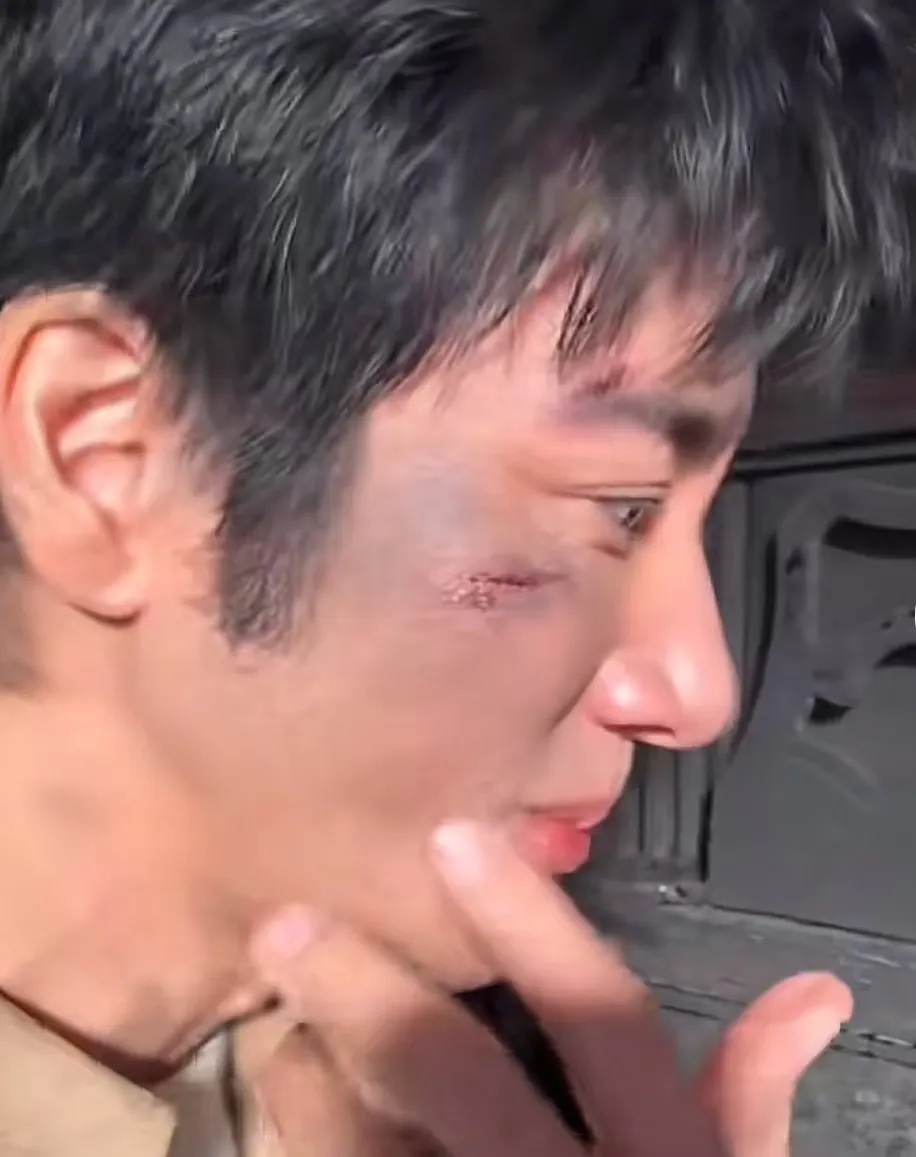 48岁歌手王力宏，突发意外！