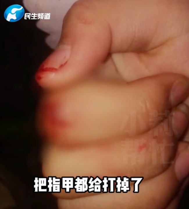 女子得知婆婆打女儿崩溃