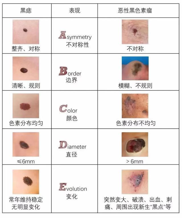指甲长出怪东西！切开后男子崩溃：竟是癌症！