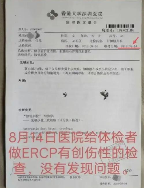 7旬老人没有肿瘤被切除5个器官 术后三个多月老人离世