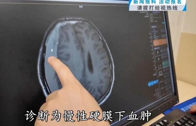 37岁男子连坐两次过山车突发颅内出血 医生提醒这些患者坐过山车需谨慎