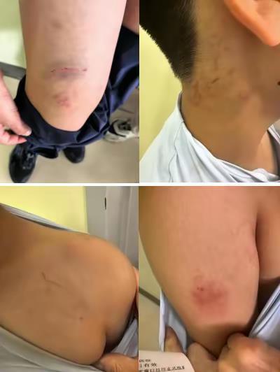 男孩疑遭机构老师扇耳光