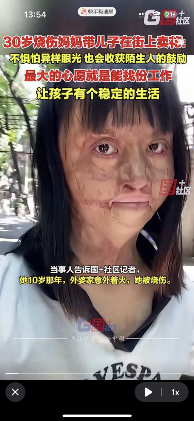 烧伤妈妈带着儿子在街上卖花 坚强面对生活