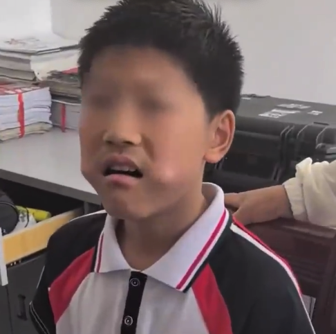 男孩把三角尺塞进嘴中被卡 温馨提示：不要什么都往嘴里塞！