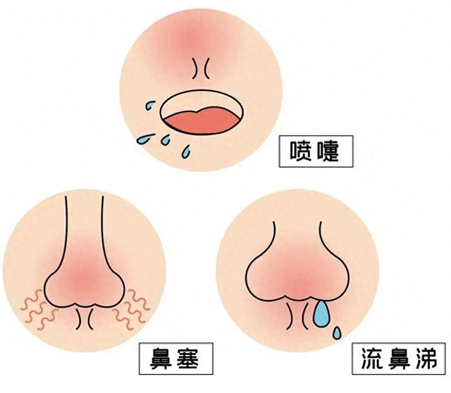 郑州民生耳鼻喉医院“鼻腔上药”疗法，解决考生鼻炎烦恼！