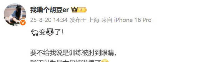 杨瀚森训练中被肘到眼睛 已转战迈阿密特训 球迷热议护目镜建议