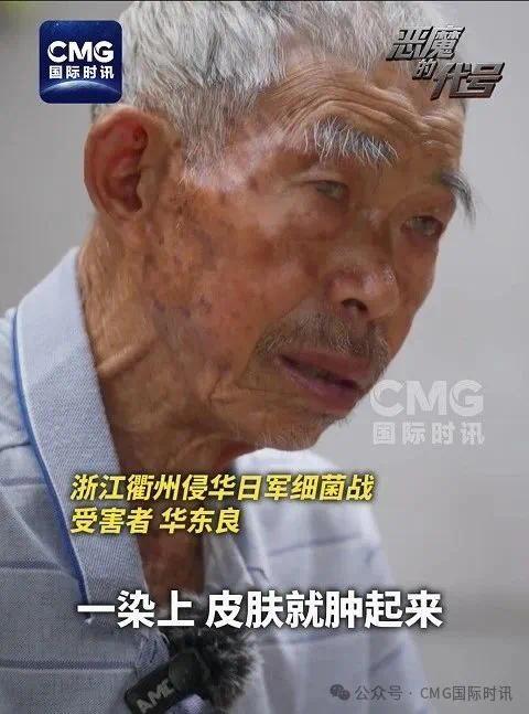 731部队强迫中国人吃带病毒的烧饼，腿上的肉一洗就掉渣！