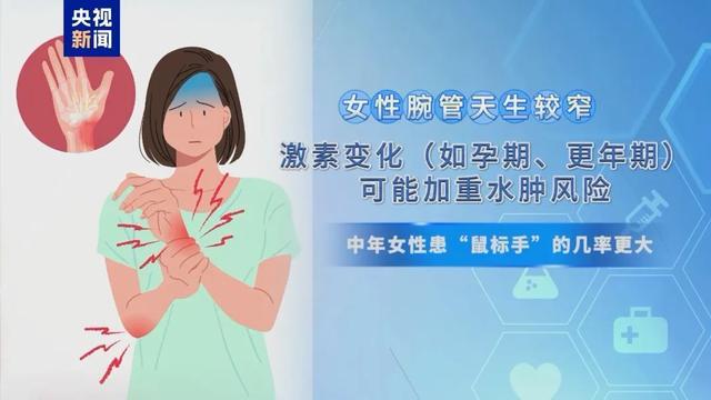 “鼠标手”纳入职业病，快自测一下！