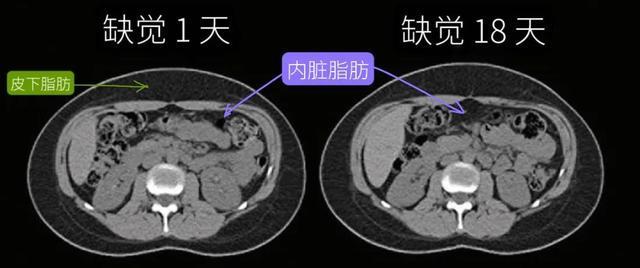 注意！这样做，可能会让肚子长胖